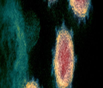 Bild von Coronaviren unter einem Elektronen Mikroskop 